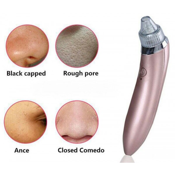 Вакуумный чистящий аппарат XN-8030 Pink (kz048)